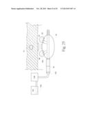 GERD TREATMENT APPARATUS AND METHOD diagram and image