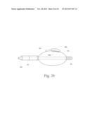 GERD TREATMENT APPARATUS AND METHOD diagram and image