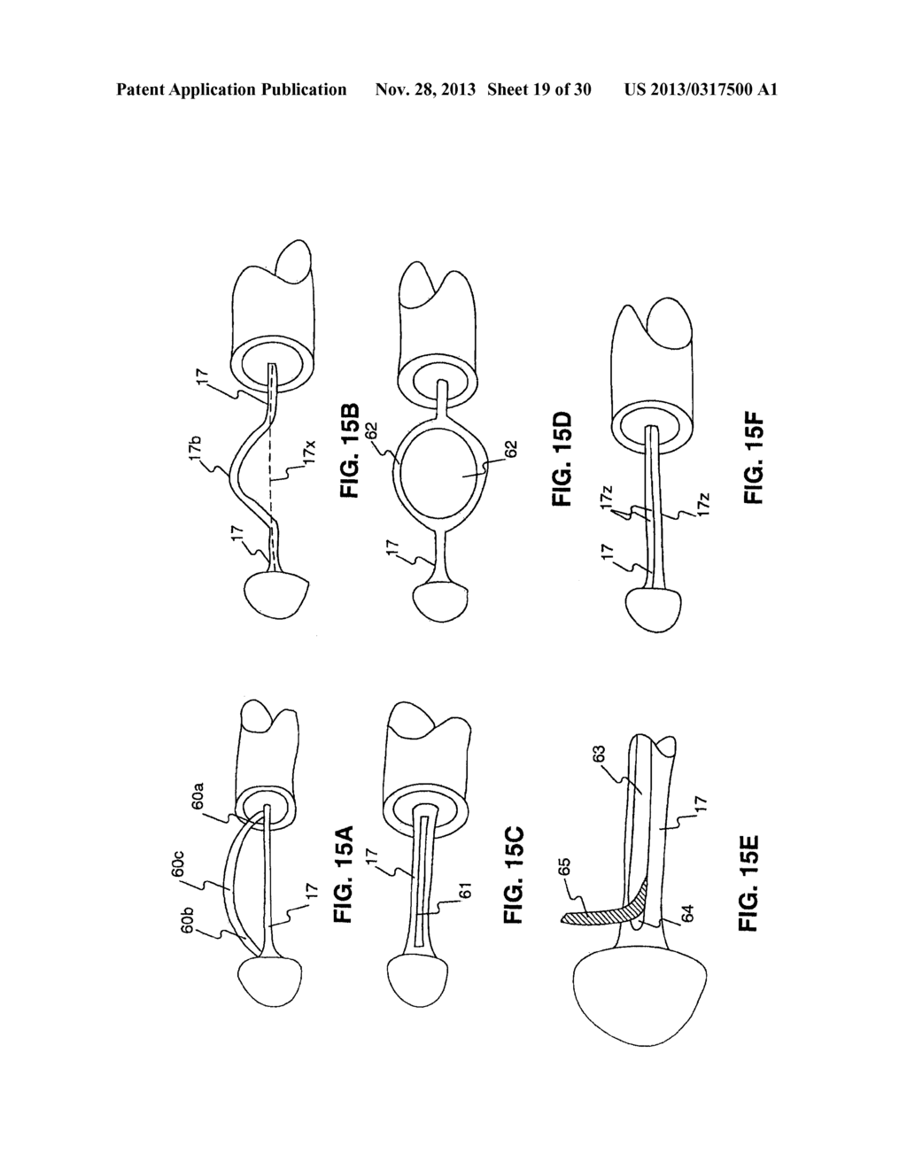 ENDOSCOPIC DEVICES AND RELATED METHODS OF USE - diagram, schematic, and image 20