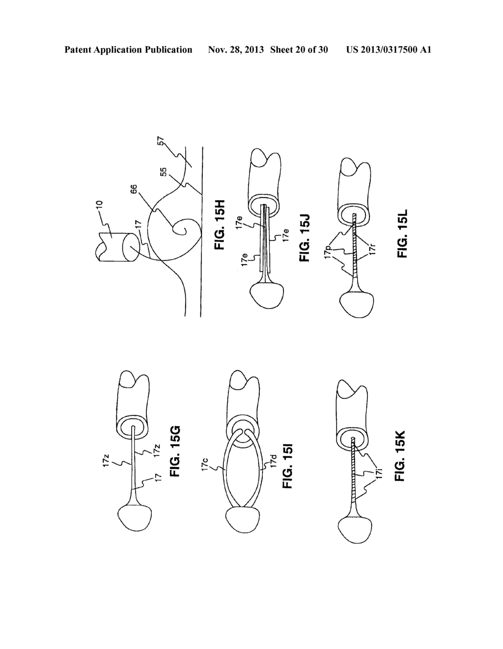 ENDOSCOPIC DEVICES AND RELATED METHODS OF USE - diagram, schematic, and image 21