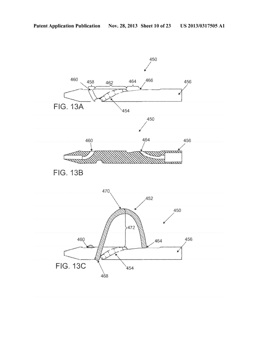 SYSTEMS AND METHODS FOR CABLE-BASED TISSUE REMOVAL - diagram, schematic, and image 11