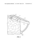 PATIENT-SPECIFIC JOINT ARTHROPLASTY DEVICES FOR LIGAMENT REPAIR diagram and image