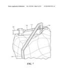 PATIENT-SPECIFIC JOINT ARTHROPLASTY DEVICES FOR LIGAMENT REPAIR diagram and image