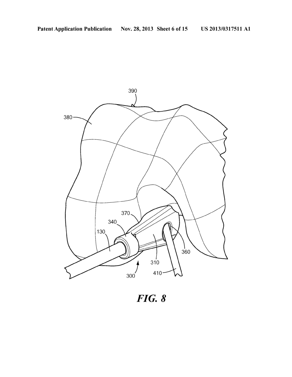 PATIENT-SPECIFIC JOINT ARTHROPLASTY DEVICES FOR LIGAMENT REPAIR - diagram, schematic, and image 07