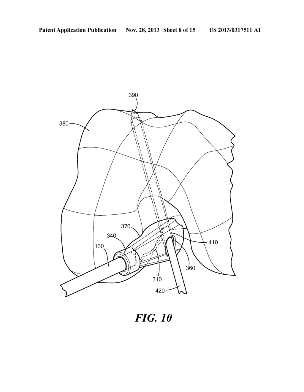 PATIENT-SPECIFIC JOINT ARTHROPLASTY DEVICES FOR LIGAMENT REPAIR - diagram, schematic, and image 09