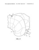 PATIENT-SPECIFIC JOINT ARTHROPLASTY DEVICES FOR LIGAMENT REPAIR diagram and image