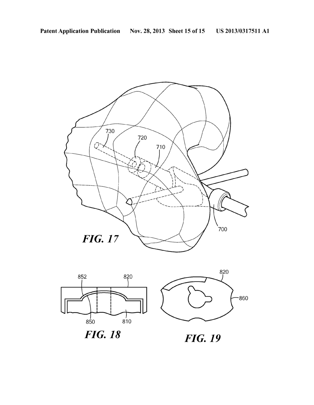 PATIENT-SPECIFIC JOINT ARTHROPLASTY DEVICES FOR LIGAMENT REPAIR - diagram, schematic, and image 16