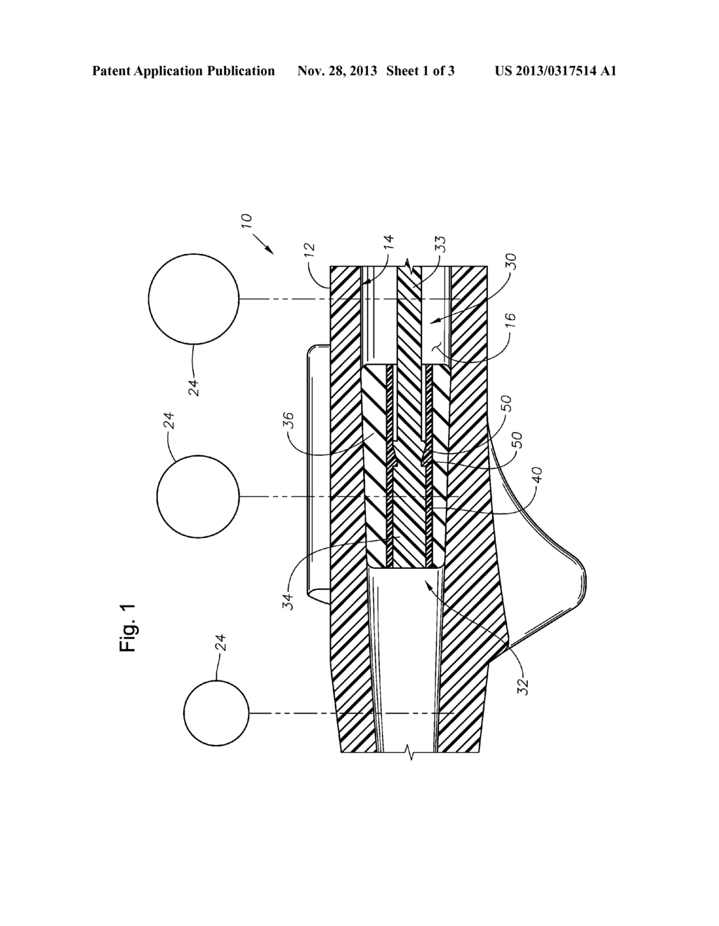 INTRAOCULAR LENS DELIVERY DEVICE WITH A MULTI-PART PLUNGER TIP - diagram, schematic, and image 02