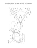 TREATMENT INSTRUMENT diagram and image