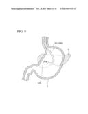 TREATMENT INSTRUMENT diagram and image