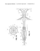 RETRIEVABLE CARDIAC DEVICES diagram and image