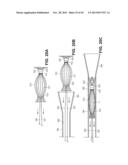 RETRIEVABLE CARDIAC DEVICES diagram and image