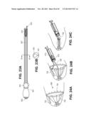 RETRIEVABLE CARDIAC DEVICES diagram and image