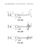 RETRIEVABLE CARDIAC DEVICES diagram and image