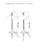 RETRIEVABLE CARDIAC DEVICES diagram and image