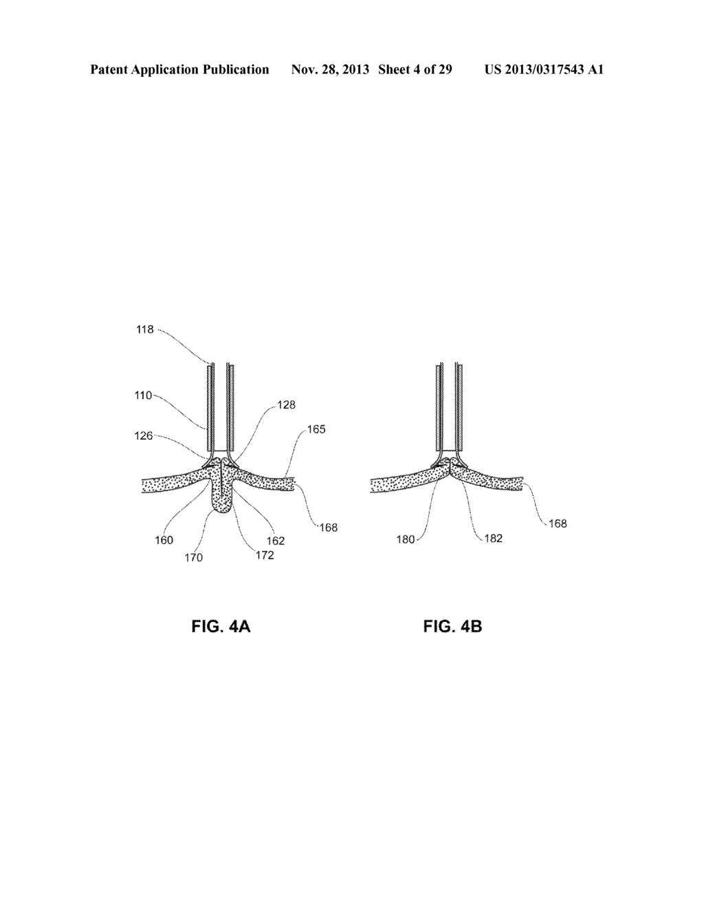 METHODS, DEVICES AND SYSTEMS FOR APPROXIMATION AND FASTENING OF SOFT     TISSUE - diagram, schematic, and image 05