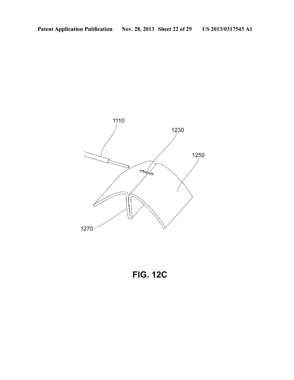 METHODS, DEVICES AND SYSTEMS FOR APPROXIMATION AND FASTENING OF SOFT     TISSUE - diagram, schematic, and image 23