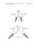 METHODS FOR STABILIZING BONE USING SPINAL FIXATION DEVICES diagram and image