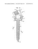 METHODS FOR STABILIZING BONE USING SPINAL FIXATION DEVICES diagram and image