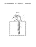 METHODS FOR STABILIZING BONE USING SPINAL FIXATION DEVICES diagram and image