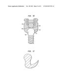 METHODS FOR STABILIZING BONE USING SPINAL FIXATION DEVICES diagram and image