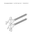 METHODS FOR STABILIZING BONE USING SPINAL FIXATION DEVICES diagram and image