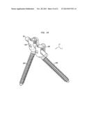 METHODS FOR STABILIZING BONE USING SPINAL FIXATION DEVICES diagram and image