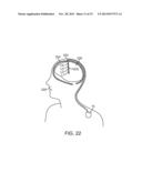 COMBINATION ELECTRICAL STIMULATION AND LOW-LEVEL LASER THERAPY diagram and image