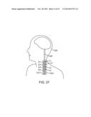 COMBINATION ELECTRICAL STIMULATION AND LOW-LEVEL LASER THERAPY diagram and image