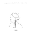 COMBINATION ELECTRICAL STIMULATION AND LOW-LEVEL LASER THERAPY diagram and image