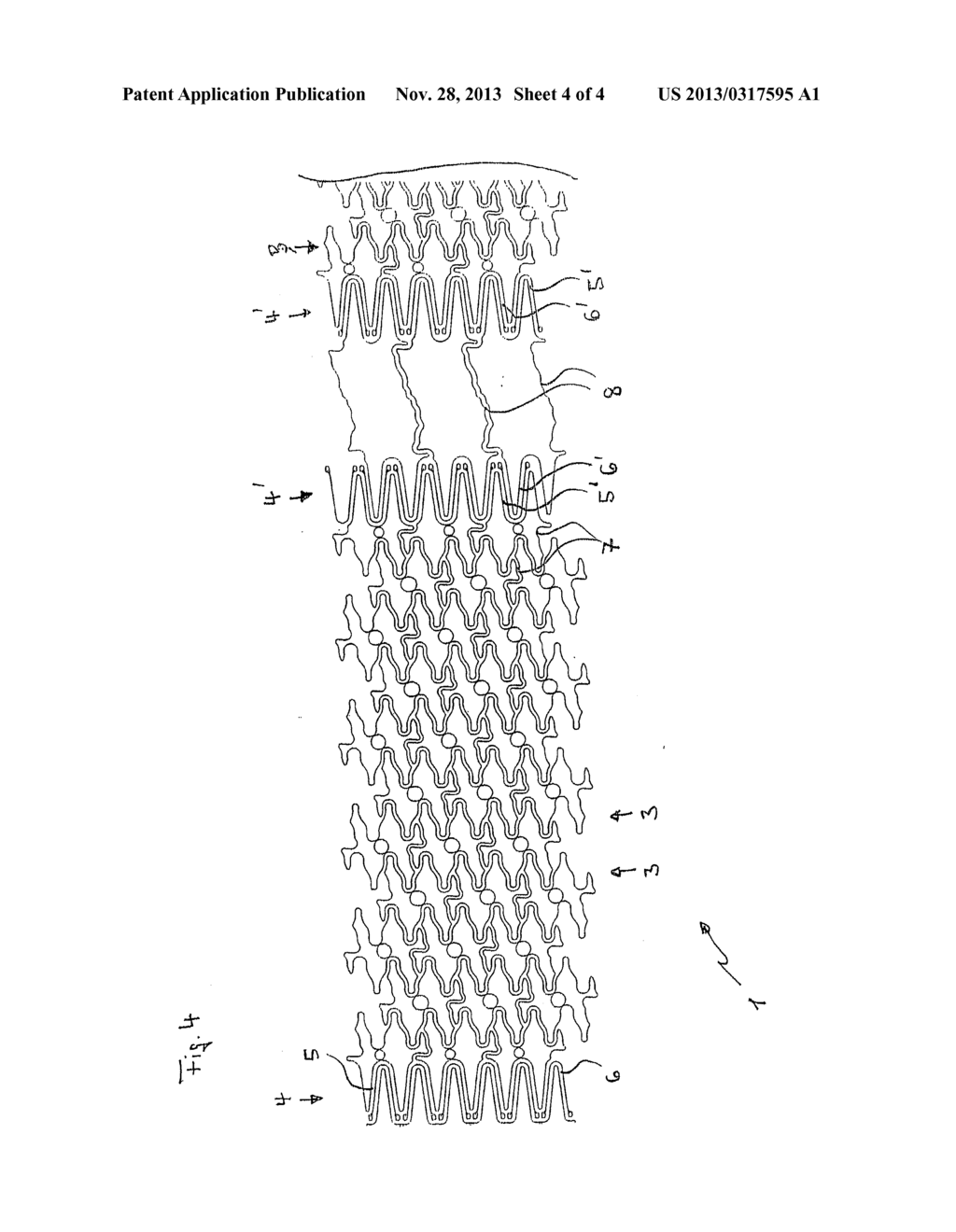 STENT GRAFT - diagram, schematic, and image 05