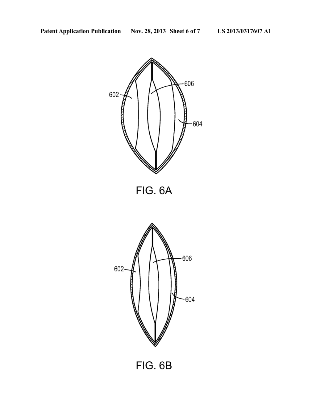 ACCOMODATING INTRAOCULAR COMPOSITE LENS AND RELATED METHODS - diagram, schematic, and image 07