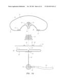 GEL-SIMULATING AND MODULATING BUTTRESS PROSTHESIS diagram and image