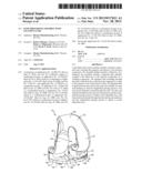 Knee Prosthesis Assembly With Ligament Link diagram and image