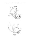 Knee Prosthesis Assembly With Ligament Link diagram and image