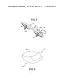 Knee Prosthesis Assembly With Ligament Link diagram and image