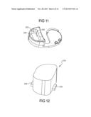 Knee Prosthesis Assembly With Ligament Link diagram and image