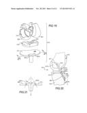 Knee Prosthesis Assembly With Ligament Link diagram and image