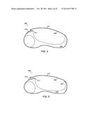 CONFORMAL HAND BRACE diagram and image