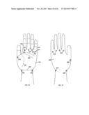 CONFORMAL HAND BRACE diagram and image