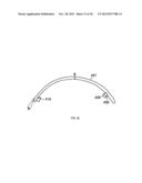 CONFORMAL HAND BRACE diagram and image