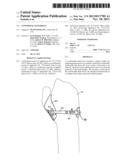 CONFORMAL HAND BRACE diagram and image