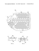 CONFORMAL HAND BRACE diagram and image