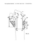 CONFORMAL HAND BRACE diagram and image