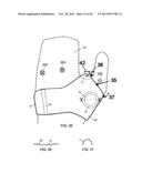 CONFORMAL HAND BRACE diagram and image