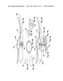 DYNAMIC ARCH STABILIZATION AND REHABILITATIVE SHOE MIDSOLE/INSOLE DEVICE diagram and image