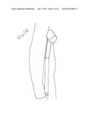 Ergonomic Crutch diagram and image