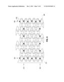 Stents With Radiopaque Markers diagram and image