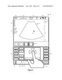 SYSTEMS AND METHODS FOR INTERFACING WITH AN ULTRASOUND SYSTEM diagram and image