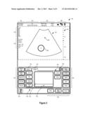 SYSTEMS AND METHODS FOR INTERFACING WITH AN ULTRASOUND SYSTEM diagram and image